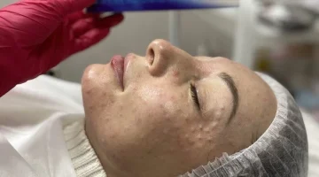 Клиника косметологии Бьюти Мед на проспекте Ленинского Комсомола изображение 3